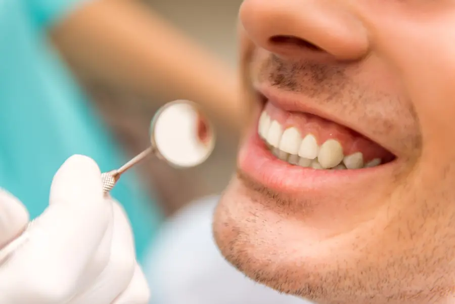 La pulizia dei denti è sempre fondamentale: ecco perché