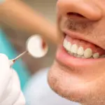 La pulizia dei denti è sempre fondamentale: ecco perché